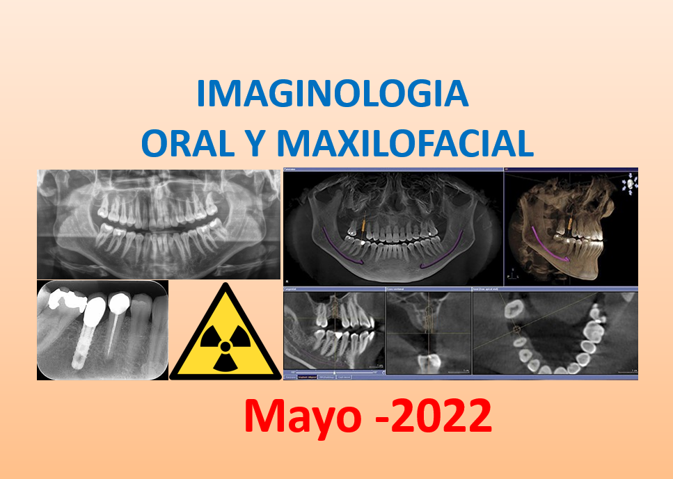 Course Image IMAGINOLOGIA ORAL Y MAXILOFACIAL