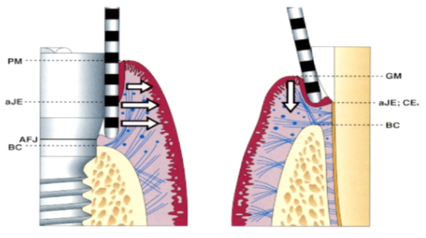 Course Image FUNDAMENTOS BASICOS DE IMPLANTOLOGIA