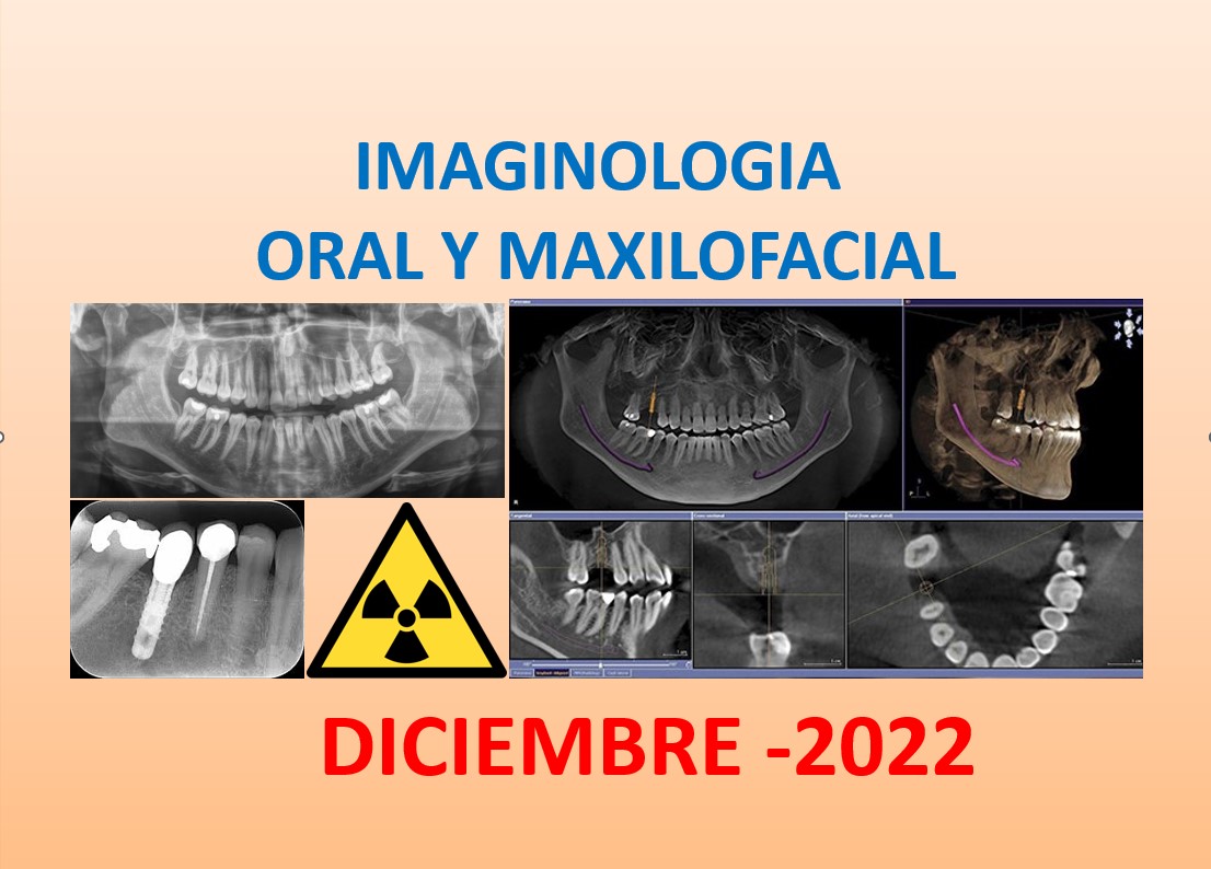 Course Image IMAGINOLOGIA ORAL Y MAXILOFACIAL