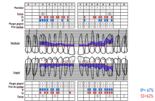 Course Image CLINICA DE PERIODONCIA I