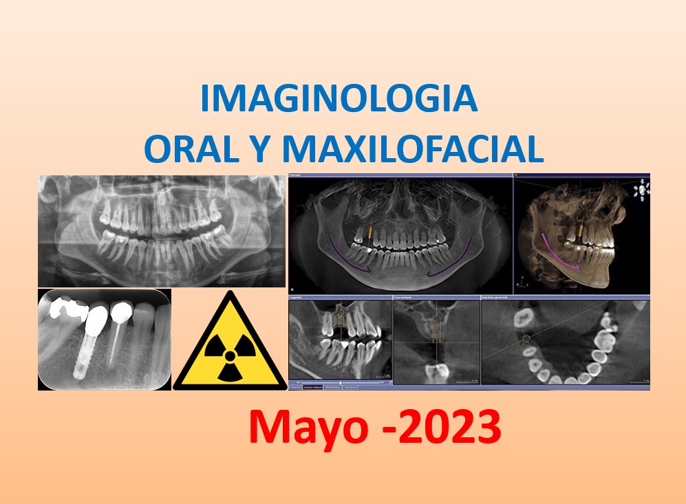 Course Image IMAGINOLOGIA ORAL Y MAXILOFACIAL